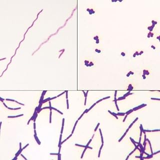 Bacteria Types Slide, Separate Smears, Gram Stain