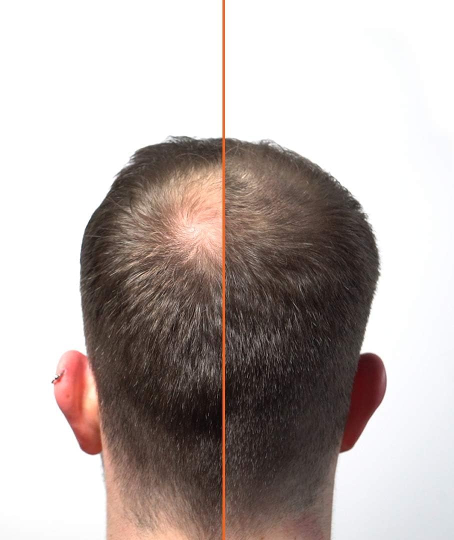 HairLab 100% Organic Hair-Thickening Keratin Fibres for Concealing Hair Loss and Thinning Hair - 15g Medium Brown - Image 4