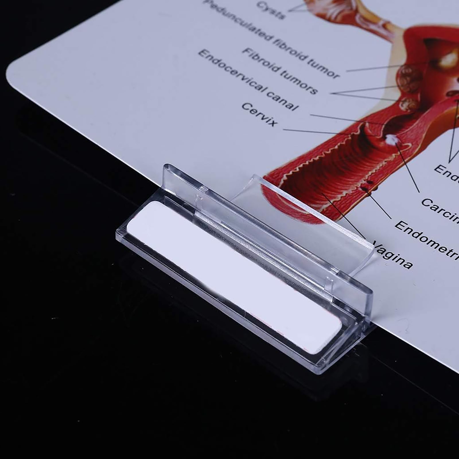 Amazon.co.jp: 人体子宮模型, 子宮と卵巣の病理学的模型1:1, 女性