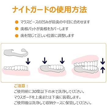 Amazon.co.jp: マウスピース 歯ぎしり 2個入り 「歯科医師監修
