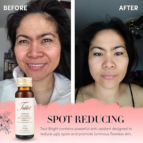 Miniatura 5 de TAUT Colágeno líquido para mujer  Bebida de colágeno marino de 13,000 mg con ácido hialurónico, semilla de uva y elastina  Soporte visible para la