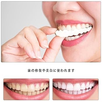 臨時歯の修復パッチ パッチ義歯 義歯 義歯カバー マウスピース 4個 Amazon.co.jp: 4対のパッチ付き義歯-義歯の頂部と底部の臨時義歯