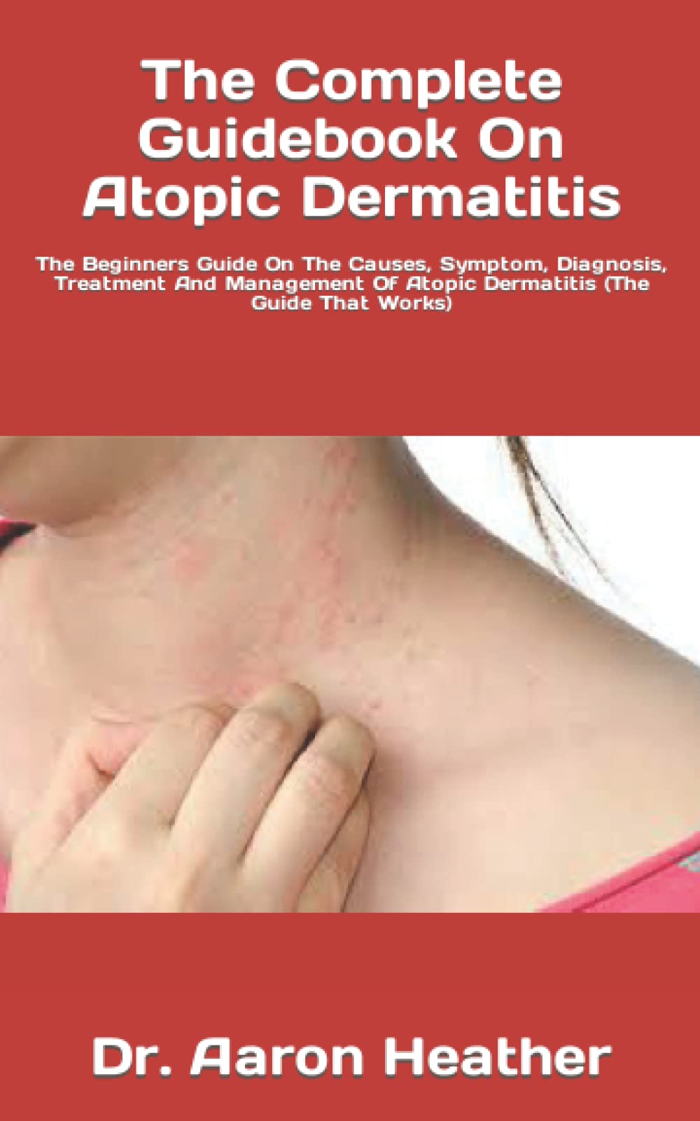 Buy The Complete Guidebook On Atopic Dermatitis The Beginners Guide On