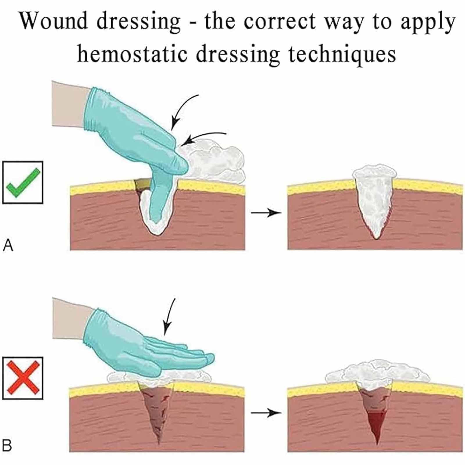 Modelo De Entrenamiento para Detener El Sangrado, Kit De Entrenamiento para Empaquetar Heridas En El Muslo, Modelo De Simulador De Laceración, Practicar Técnicas De Vendaje Hemostático