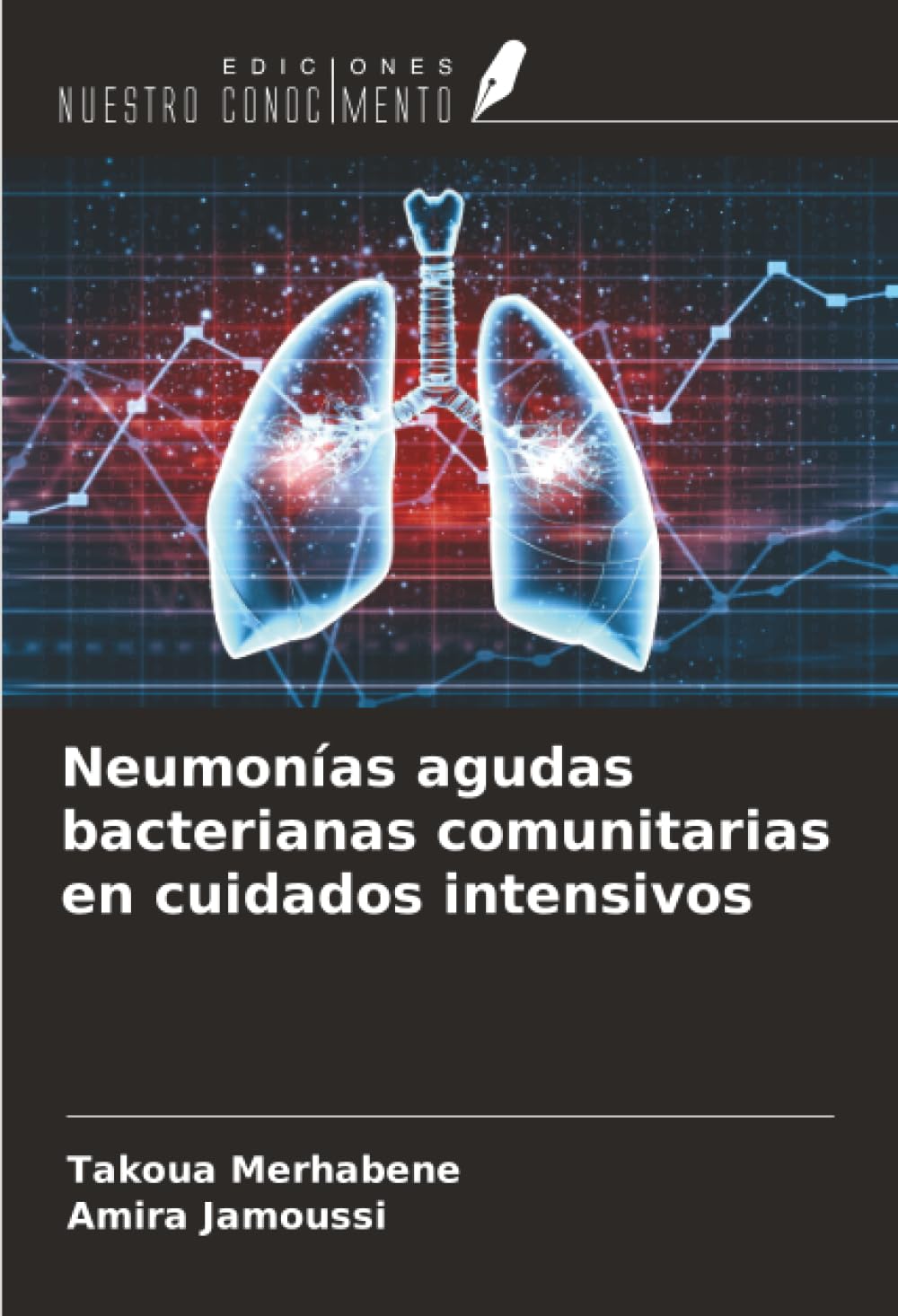 Neumonías agudas bacterianas comunitarias en cuidados intensivos
