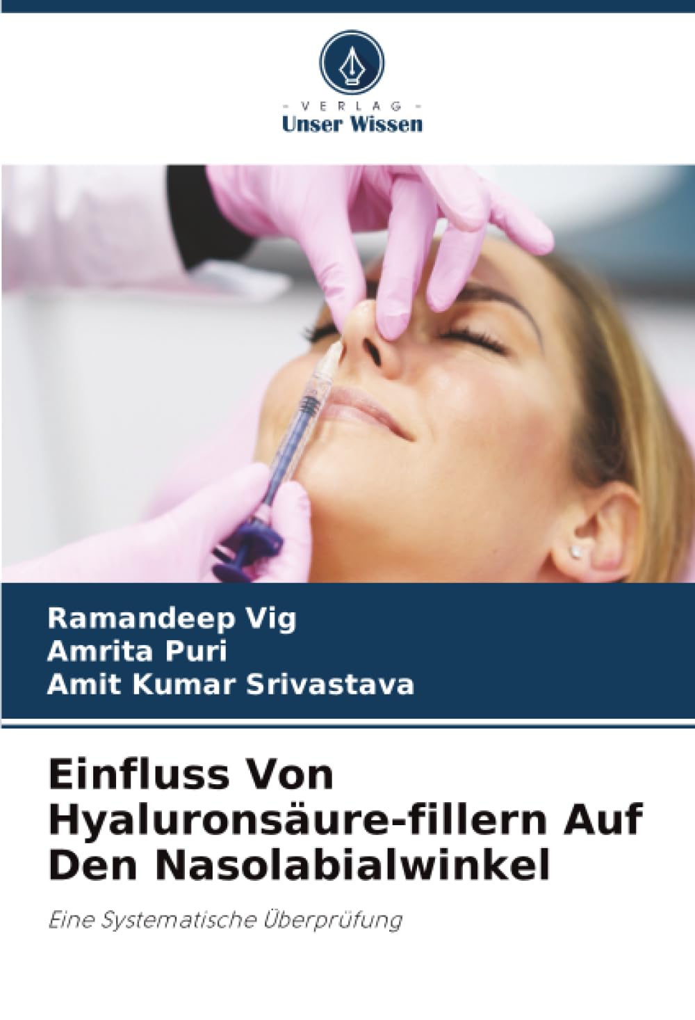 Einfluss Von Hyaluronsäure-fillern Auf Den Nasolabialwinkel: Eine Systematische Überprüfung