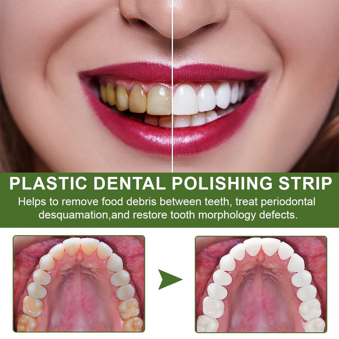Caja De Tiras De Pulido Dental 6 Metros Pulidor De Dientes De Doble Cara Papel De Lija Dental 30μ