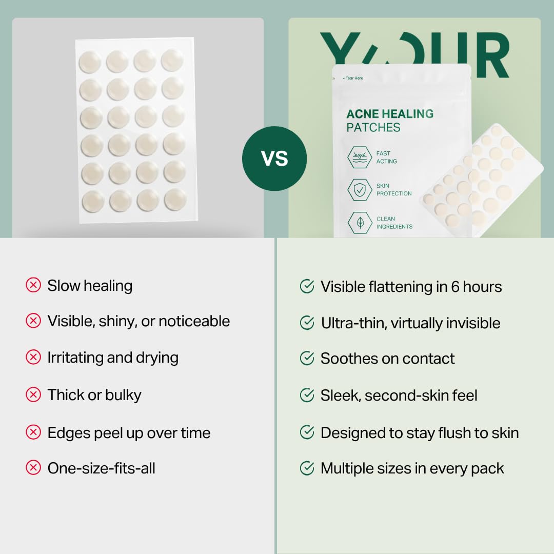 Y’OUR Improving Acne Patches: Professional Hydrocolloid Pimple Patch for Face; Ultra-Thin, Purifies & Alleviates Stubborn Blemishes, Promotes Healing, Effective Zit Treatment. Made in USA. 56 Count
