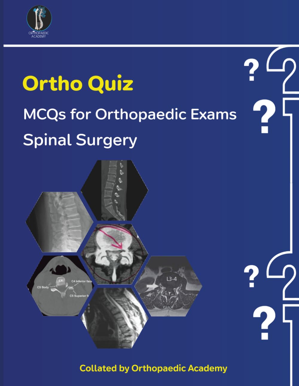 Ortho Quiz: Spinal MCQs (Concise Orthopaedics)