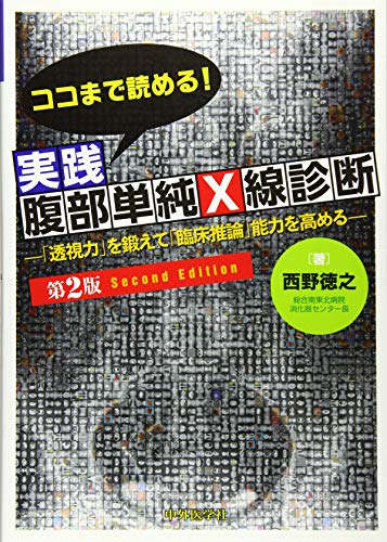 オライリー 無料電子書籍 ココまで読める!実践腹部単純X線診断―「透視力」を鍛えて「臨床推論」 バイ