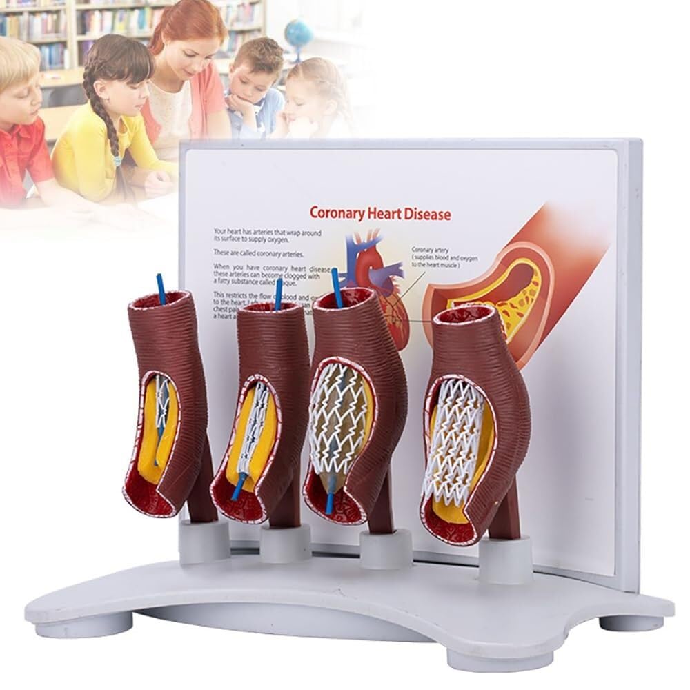 model anatomiczny, Model nauczania okluzji naczyń krwionośnych