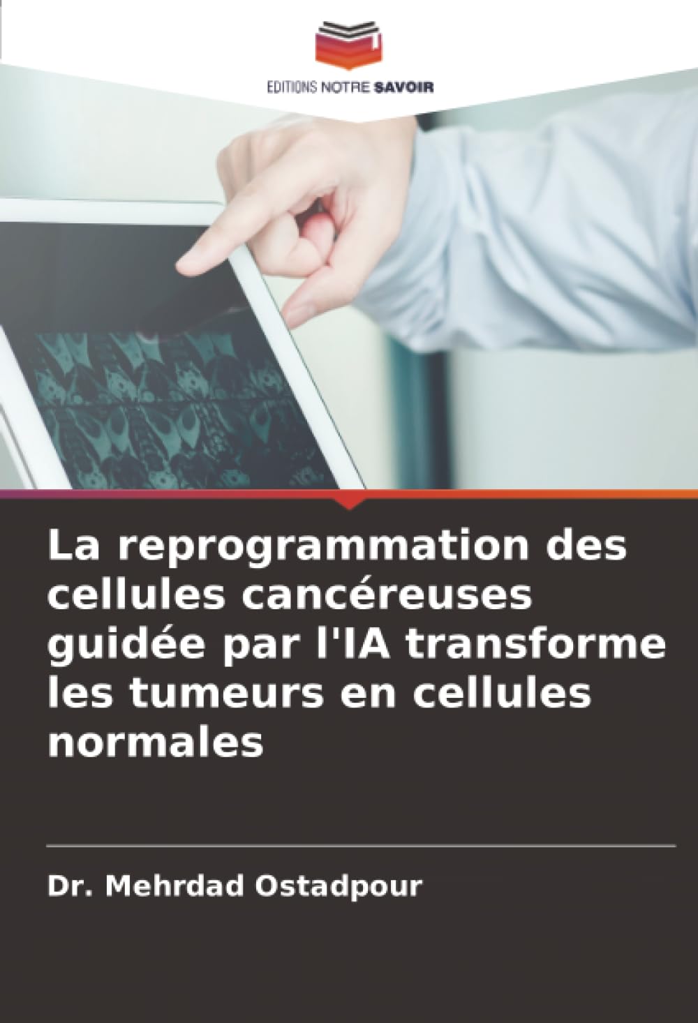La reprogrammation des cellules cancéreuses guidée par l'IA transforme les tumeurs en cellules normales