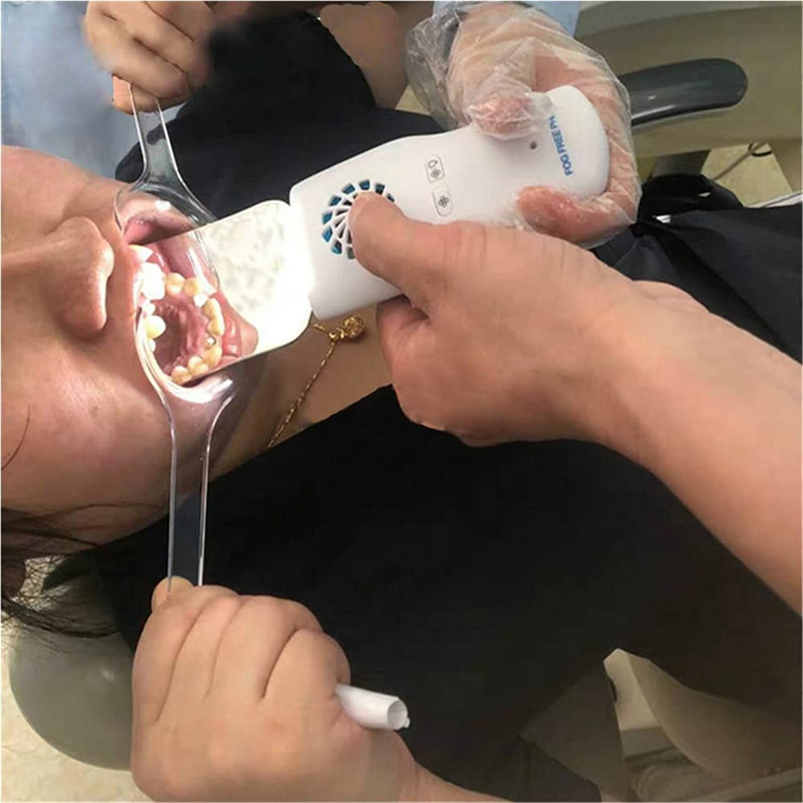 Specchi per fotografia dentale, specchi intraorali antiappannamento con impugnatura, kit per cure odontoiatriche, specchio per ortodonzia a LED riflettore dentale a doppia faccia