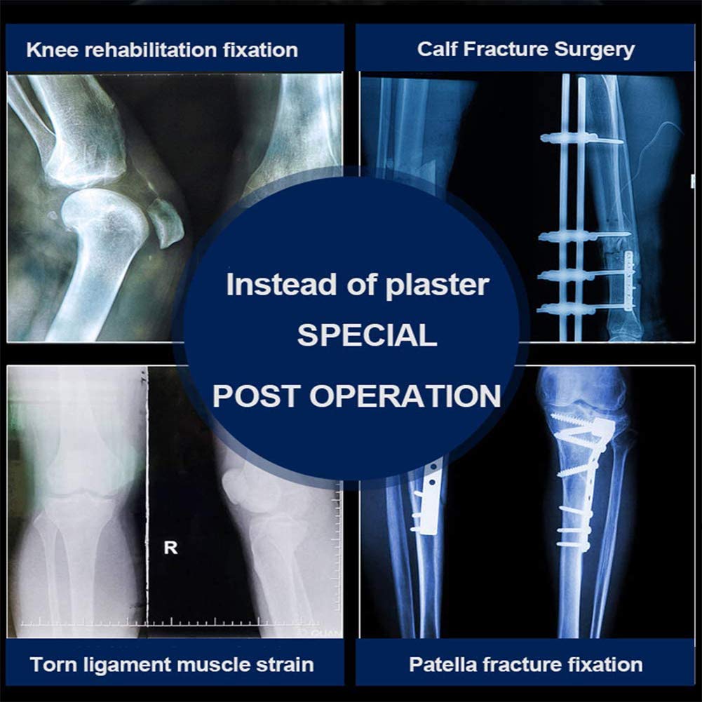IBOWZ Tutore per Ginocchio Supporto per immobilizzatore per lesioni rotulee Post operatorio Regolabile Supporto per Ginocchio Rom incernierato Ideale per lesioni Acl/Legamento/Sport