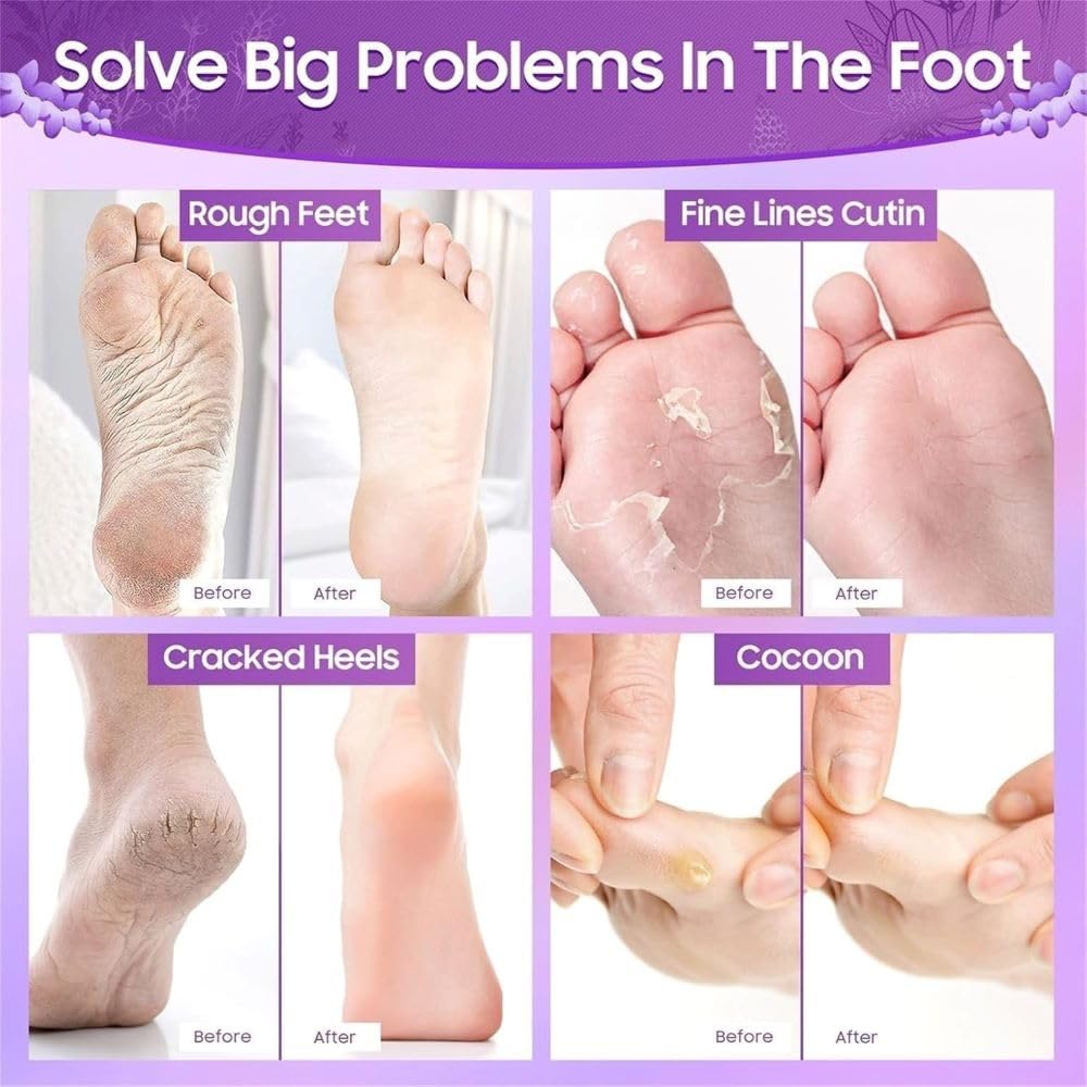 Krupasadhya Foot Peeling Mask For Dead Skin Removal, Peeling & Exfoliating Foot Mask for Dry Cracked Feet, Removes Dead Skin & Calluses, Men And Women Feet Peeling Mask Exfoliating. (Lavender) 1