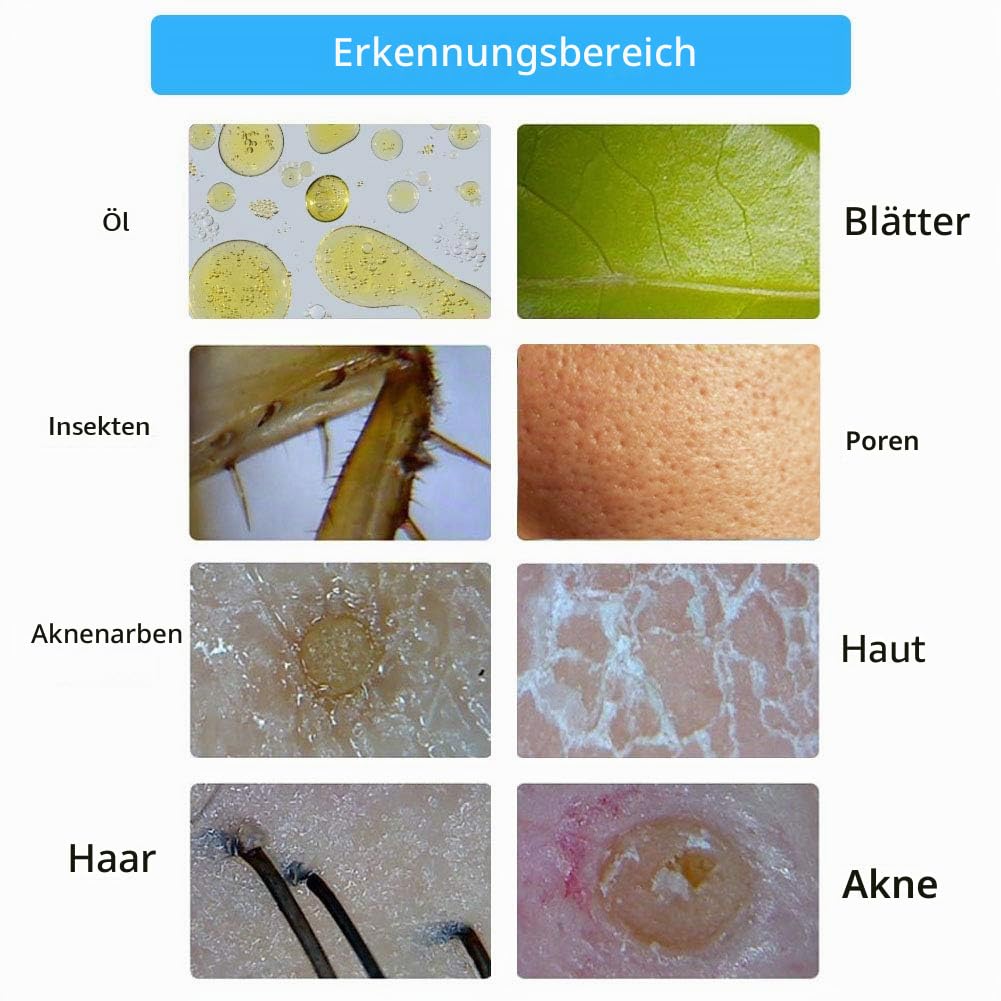 Hautanalysegerät Professionelles Haaranalysegerät 10,1 Zoll Lademikroskop Kopfhaut Haarfollikel Hauthaardetektor Analysegerät Hautdiagnose Haaranalysegerät Feuchtigkeitstester