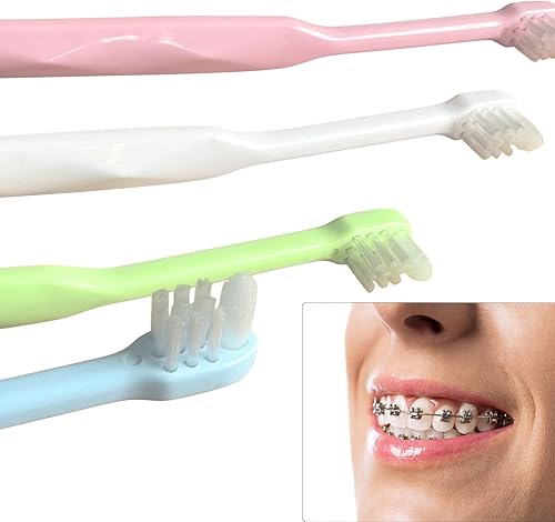 Miniatura 5 de Cepillo de dientes de ortodoncia, cepillo de dientes pequeño y compacto para limpieza de detalles de frenillos y dientes, 4 piezas (C-2)