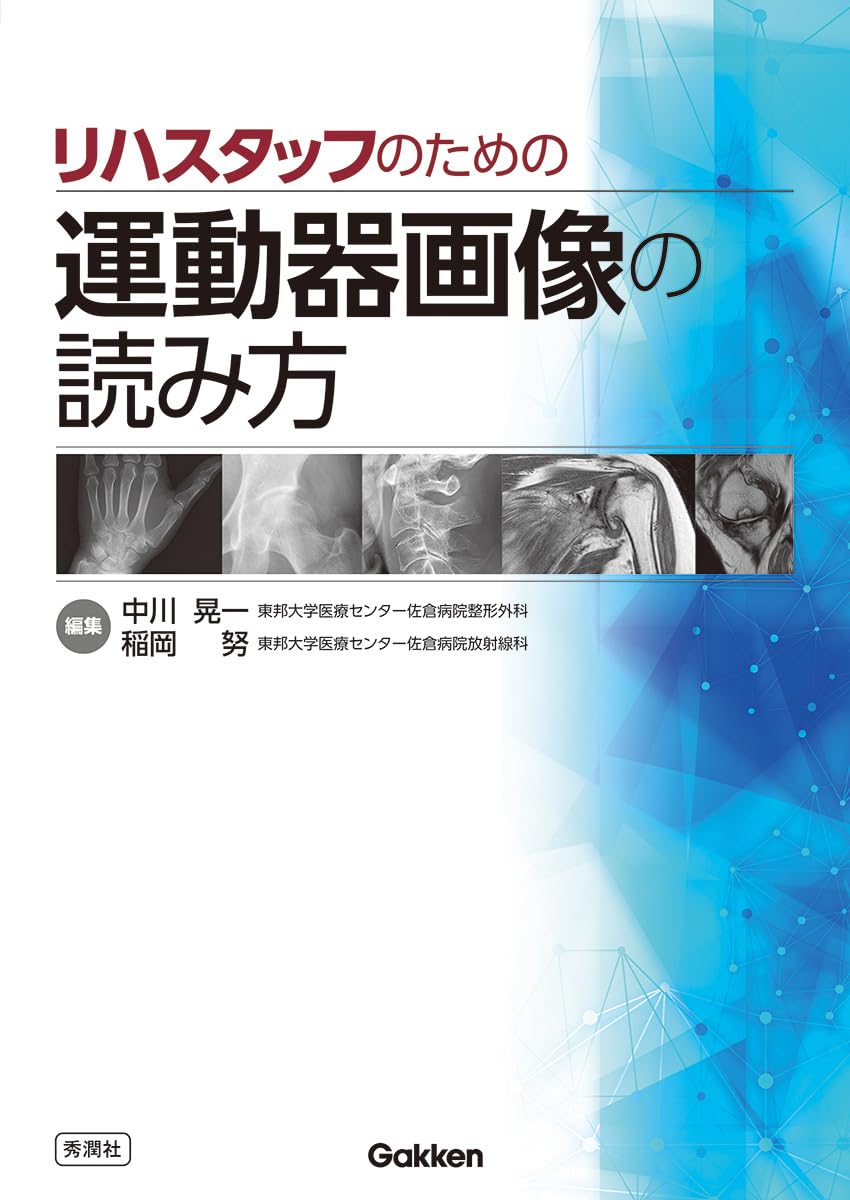 Amazon.co.jp: リハスタッフのための運動器画像の読み方 : 中川 晃一