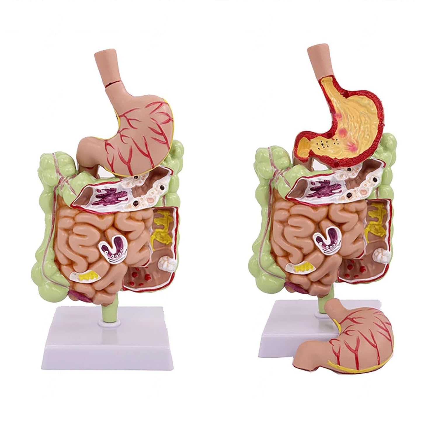 Human Stomach Anatomy Model ，Removerable Teaching Model ， Pathological Digestive System Model Stomach Section Large Small Intestine Study Education
