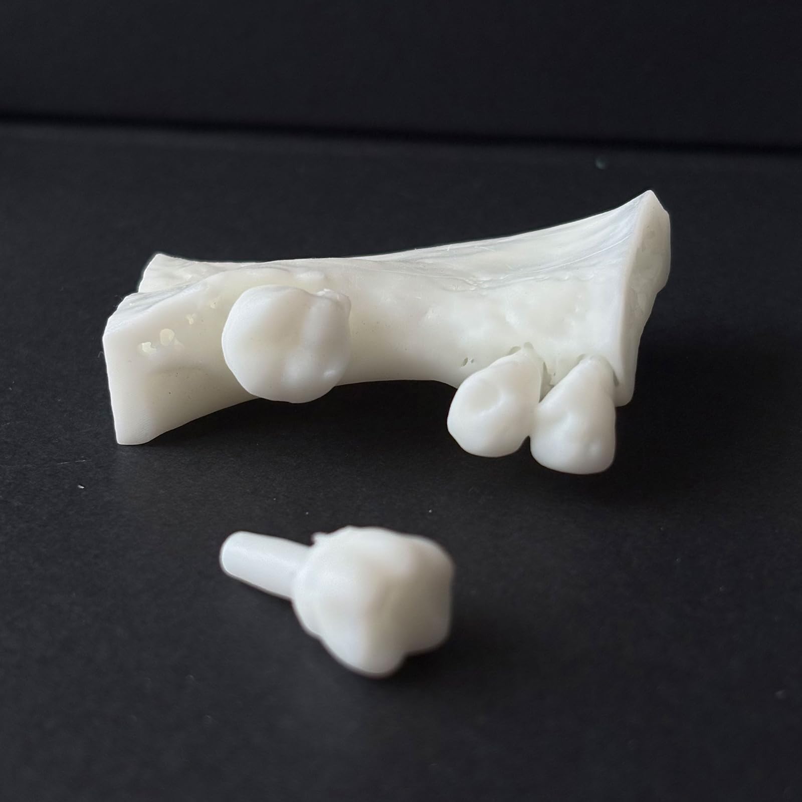 Modello di Pratica per impianto Dentale - Modello di impianto in Osso alveolare simulato - per Studenti di odontoiatria e Strumento di Formazione