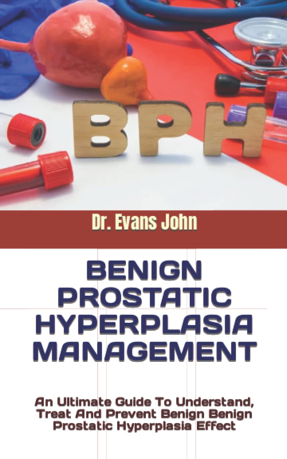 Buy BENIGN PROSTATIC HYPERPLASIA MANAGEMENT: An Ultimate Guide To Understand, Treat And Prevent