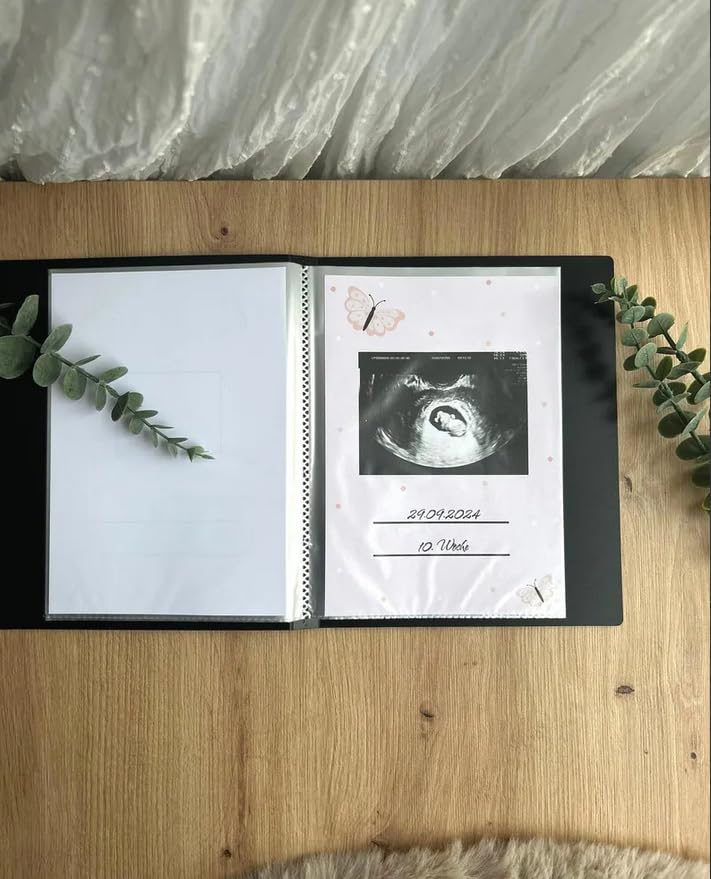 Ultraschallbilder Mappe Album für Ultraschallbilder personalisierbares Einsteckalbum stabiles Cover Erinnerungen an Schwangerschaft (mit Einlegeblättern in den Folien)