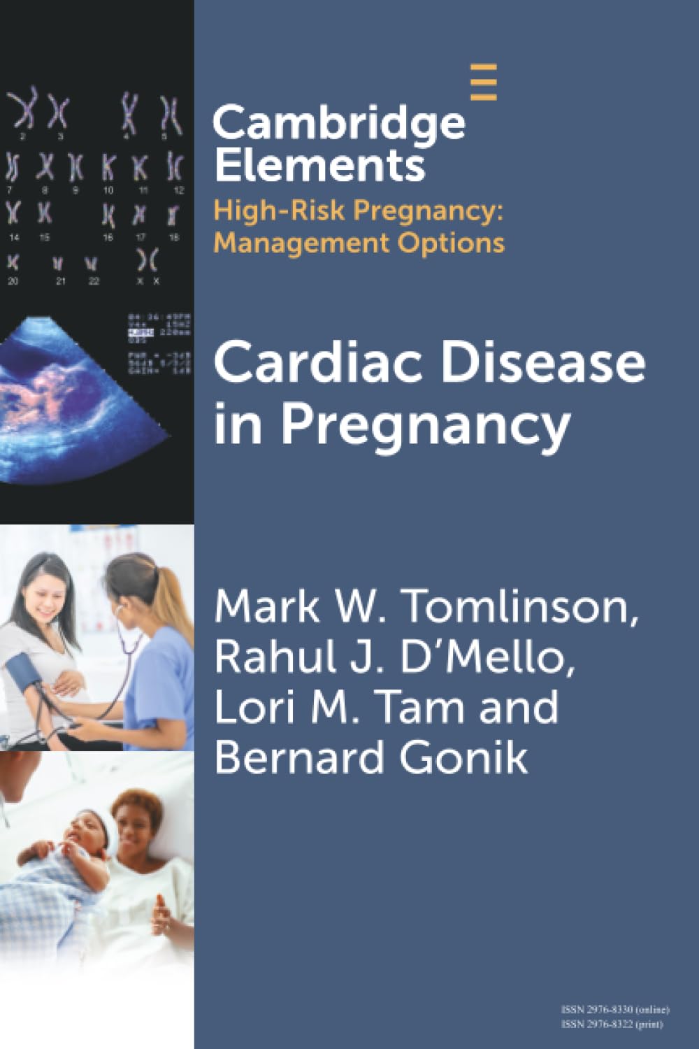 Cardiac Disease in Pregnancy (Elements in High Risk Pregnancy: Management Options)