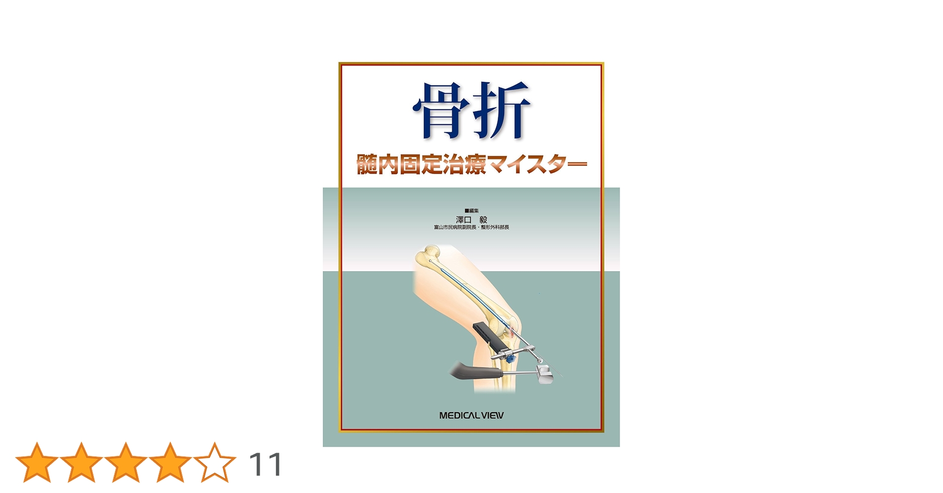 骨折 髄内固定治療マイスター 骨折 髄内固定治療マイスター | 澤口 毅 |本 | 通販 | Amazon