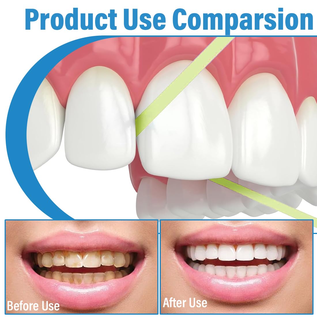 Papel De Lija Dental 3 Volúmenes, Tiras De Pulido Intersticial, Para Blanqueamiento Dental