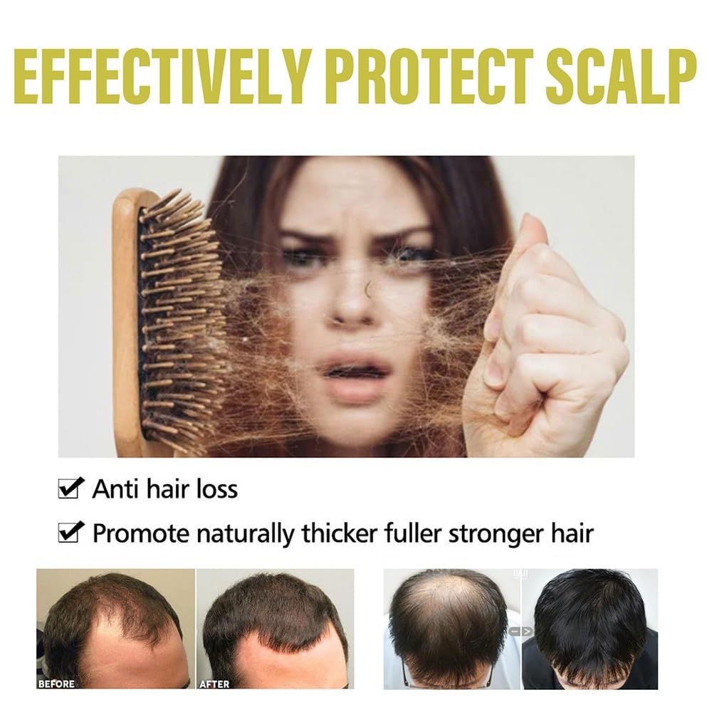 Custodia for shampoo for capelli alle erbe Polygonum allo zenzero, lavaggio nutriente delicato alla radice for capelli lisci e luminosi