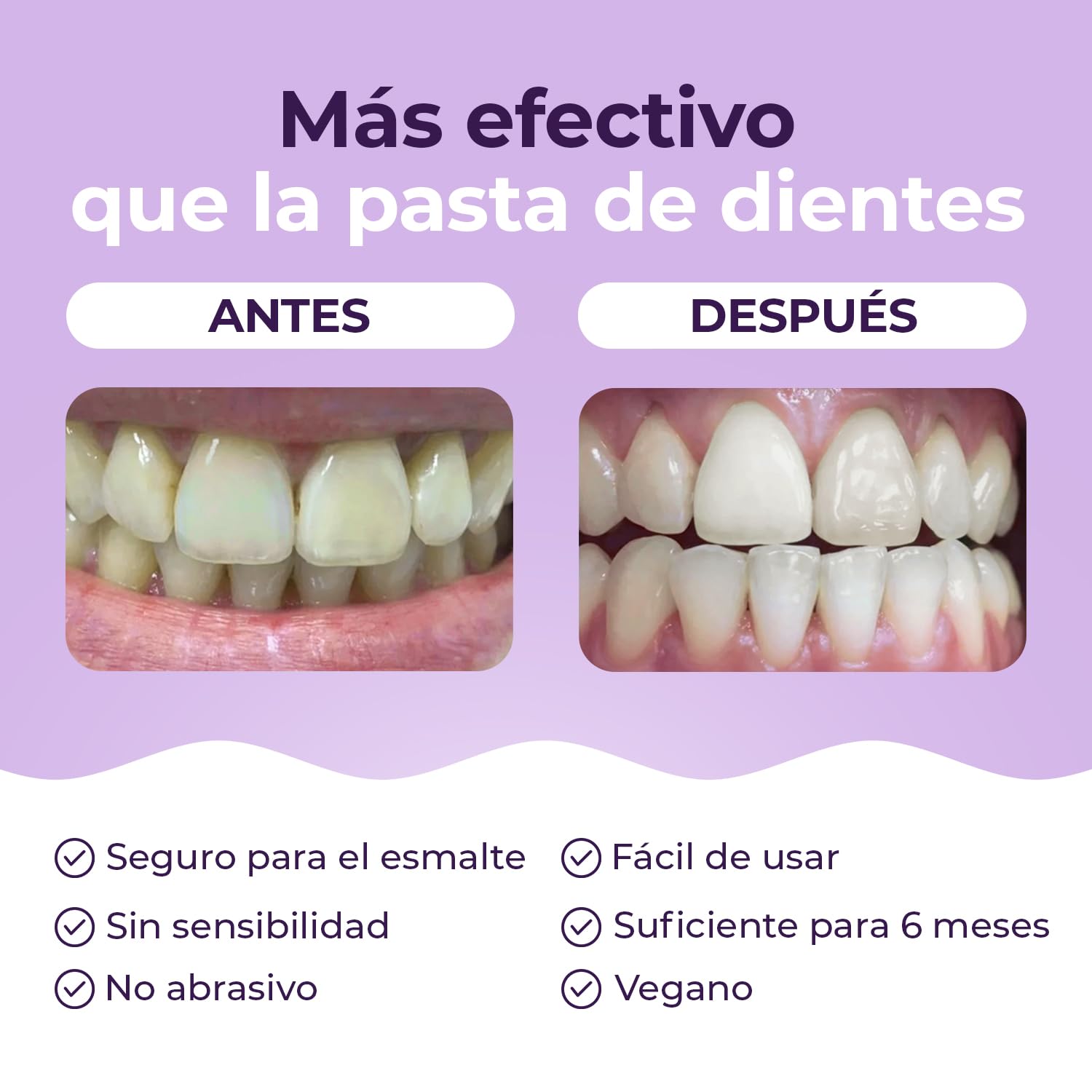 Onlysmile polvo de blanqueamiento dental para dientes blancos | Blanqueador dental professional con efecto visible | Blanquear los dientes seguro - limpieza cosmética de los dientes | Teeth Whitening | Ganador del Test 2025, Fabricado en Alemania, contra
