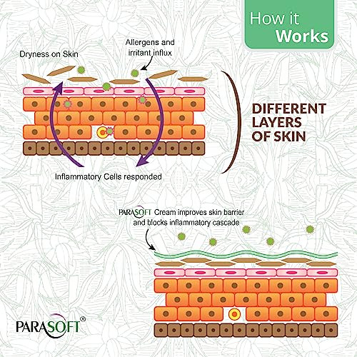 Image of Parasoft dry skin cream paraben free with added goodness of aloe vera 60g (20 g (Pack of 1))