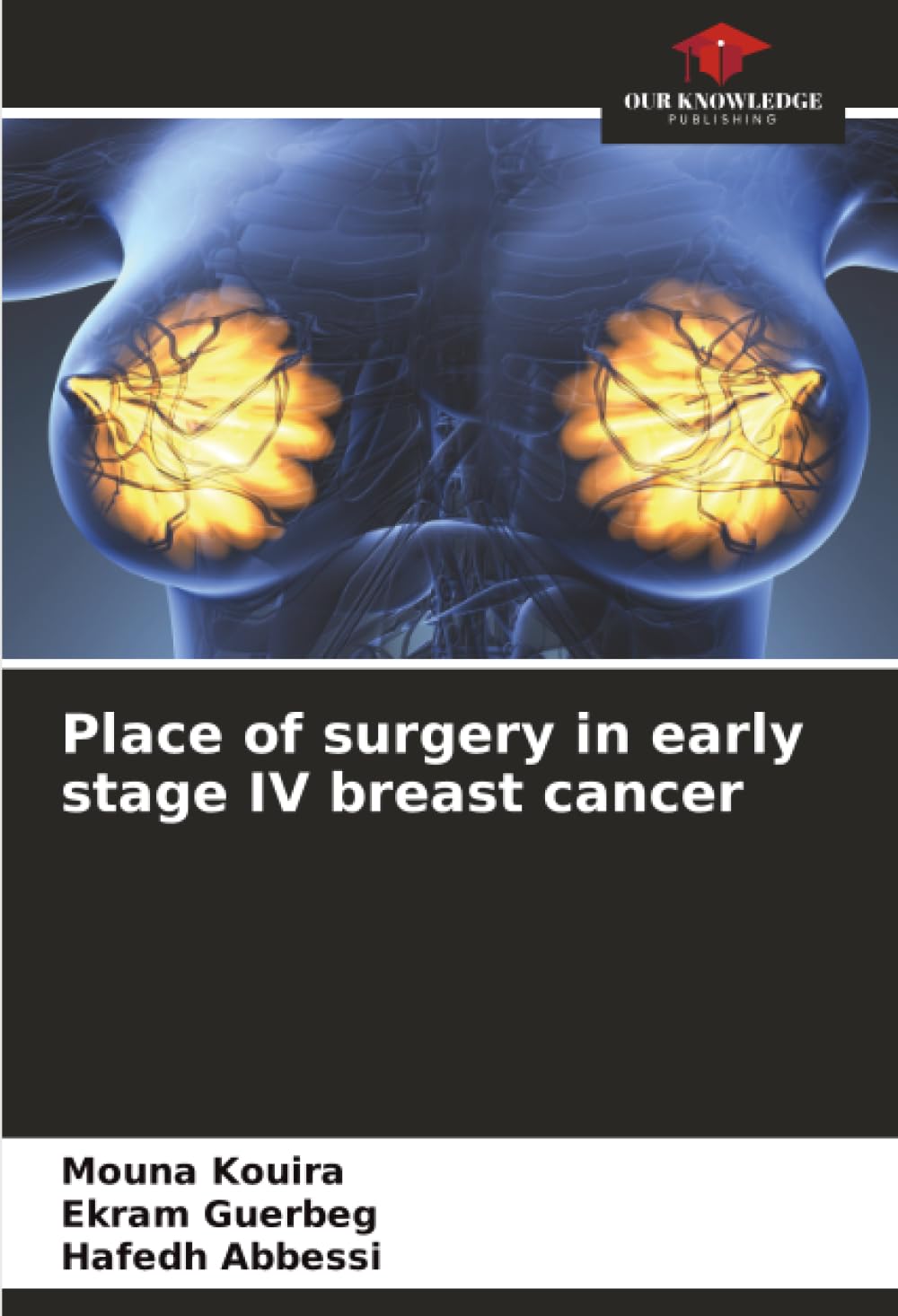 Place of surgery in early stage IV breast cancer
