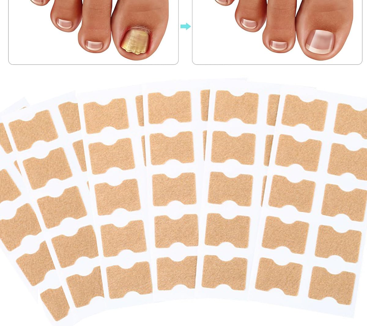 ECVV Multi-Purpose Nail Repair Patches 50Pcs, Nail Repair Toenail Treatment for Nail Fungus Damage, 8-Hour Treatment Restores Healthy Appearance