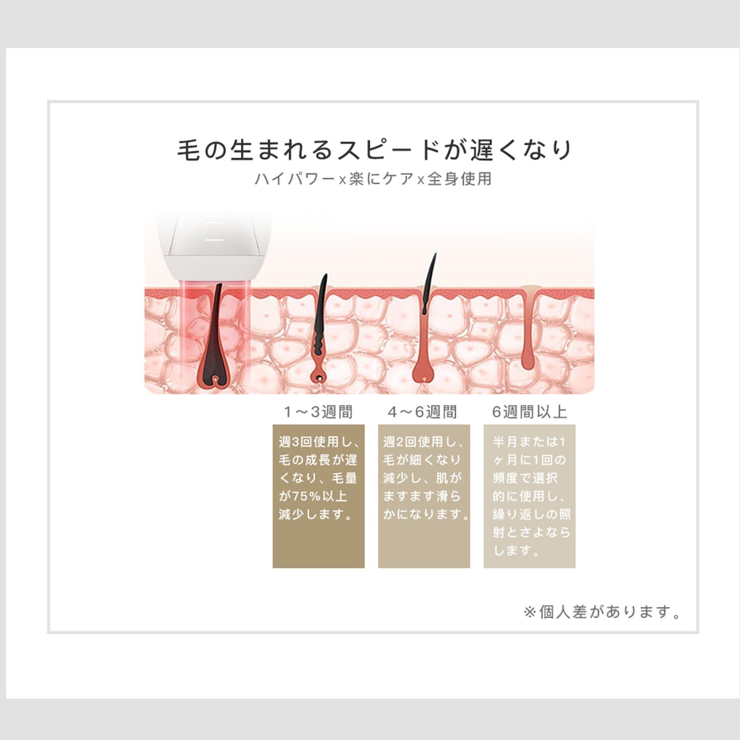 Amazon | Yete（エイティー）脱毛器 IPL 冷感無痛ケア SHR連続照射