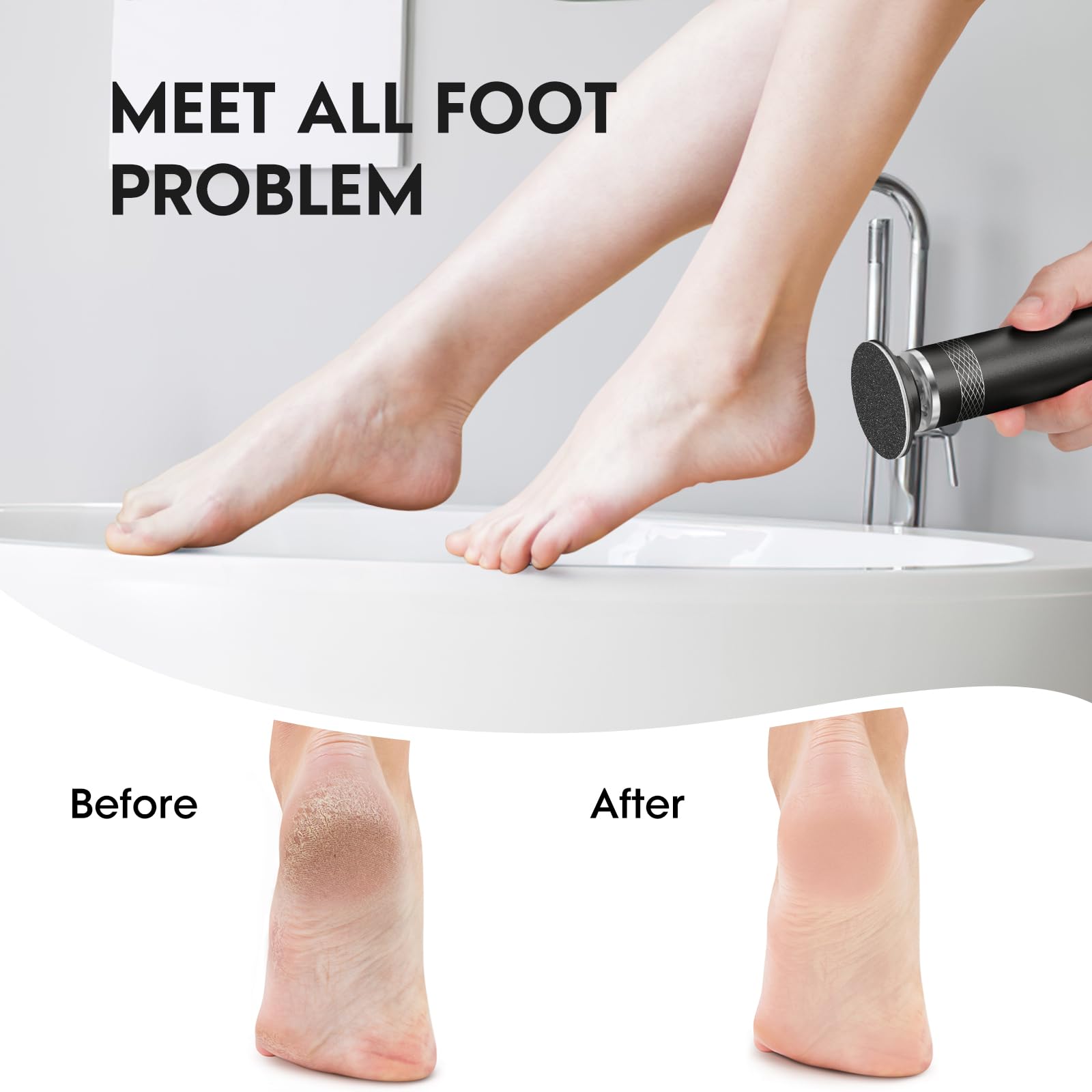 Removedor eléctrico de callos de pies mejorado, recargable, lima de pies de velocidad ajustable, herramientas de pedicura con 60 discos de papel de lija para hombres y mujeres, piel muerta, piel dura