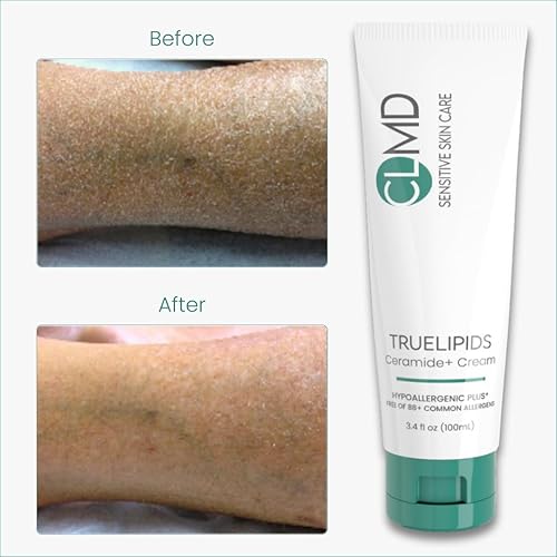 Miniatura 4 de CLMD TrueLipids Ceramide+ Cream - Soporte de barrera hidratante profunda para pieles sensibles - Hidrata y suaviza - Hipoalergénico, nutritivo y