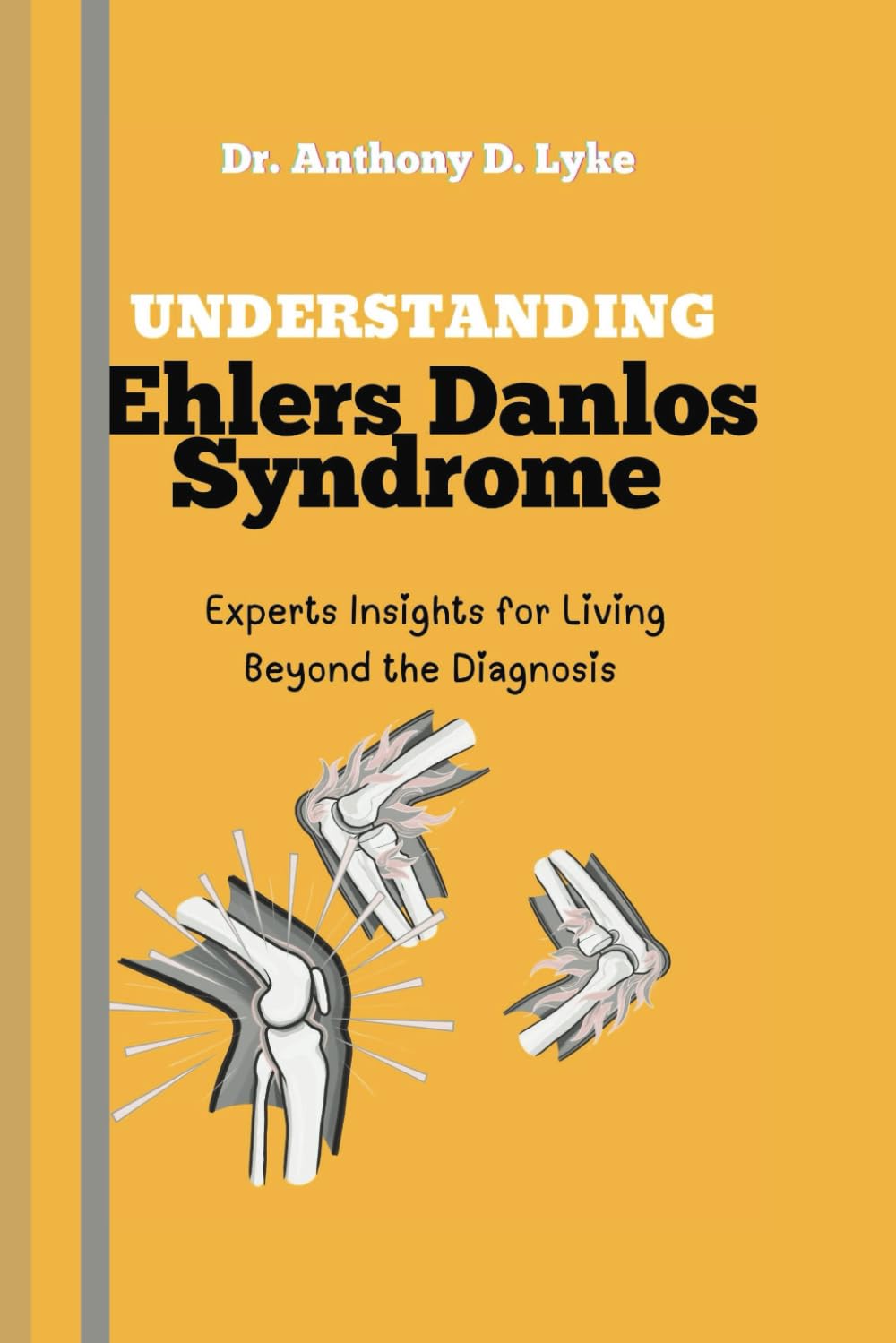 Understanding Ehlers Danlos Syndrome: Experts Insights for Living Beyond the Diagnosis