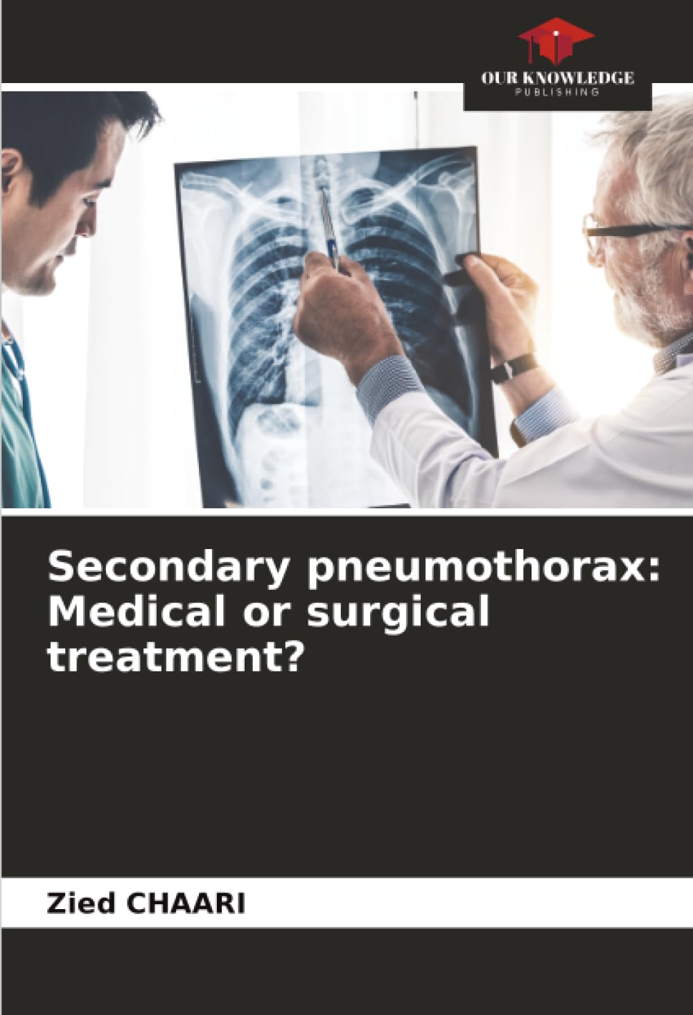 Secondary pneumothorax: Medical or surgical treatment?