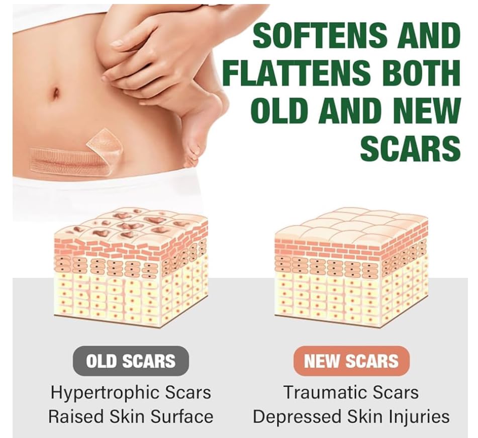 Miniatura 6 de Cinta de silicona para cicatrices, hojas de silicona de grado médico, 1.6 x 60 pulgadas, paquete de 2 unidades, tratamiento profesional de