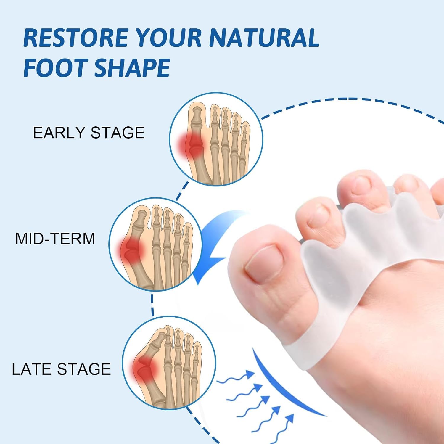 Separador Dedos Pie Silicona Corrector Dedos Pies Alivia Dolor Estres Dedo Martillo Hallux Valgus 4 Piezas