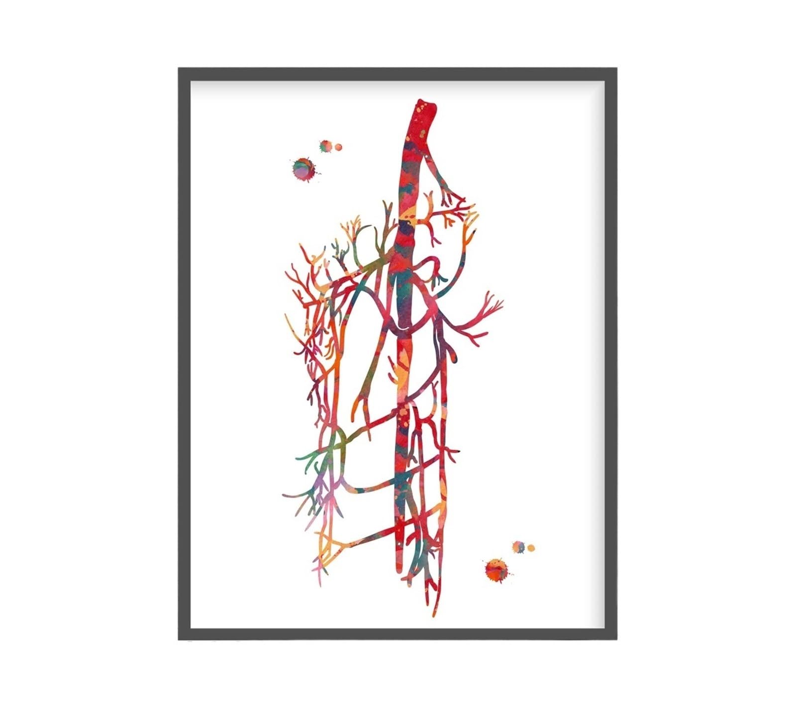 1pc Kardiologia Naczyniowa Sys Plakat Angiogram Anatomia Angiologia Chirurgia Medyczna Obraz Na Płótnie Wall Art Clinic Home Decor(9,50x70cm Unframed)