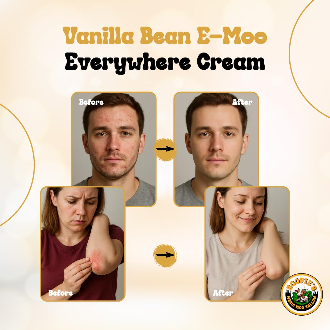 Magic Moo Beef Tallow Vanilla Bean E-Moo Moisturizing Everywhere Suet Tallow Cream with Organic Emu Oil. For Acne, Stretch Marks, Eczema, Hydration, Dry Skin & More! 8oz