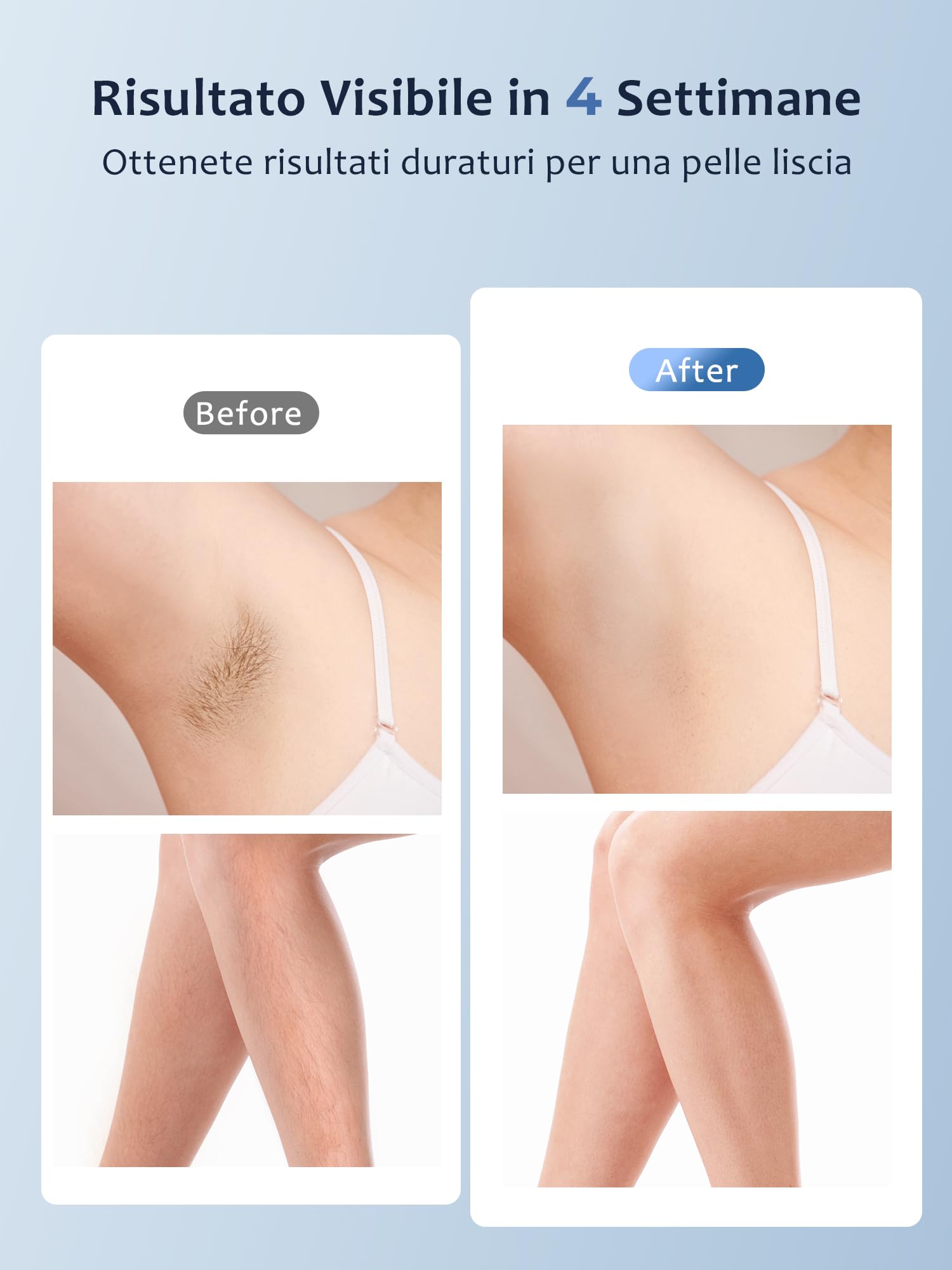 Epilatore Luce Pulsata con Funzione Ghiaccio 19,35J, Luce Pulsata 9 Livelli Energia, Epilatore Laser Flash Continuo Automatico, Depilazione luce pulsata per Donna Braccia Ascelle Gambe Corpo