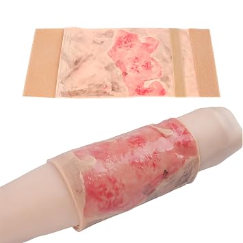 Simulated Burn Wound Model, 2-3 Degree Limb Burns Training Module, Wearable Wound Skin Model, for Burn Care Training, Medical Teaching Demonstration, for Medical Education
