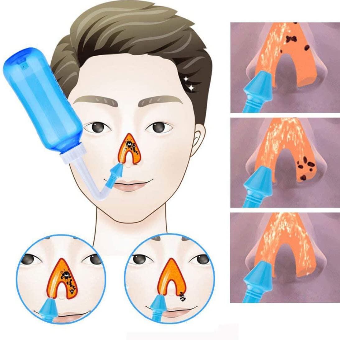 Kit de Rinçage des Sinus Bouteille Nettoyeur Lavage du Nez Irrigation Nasale pour Enfant Adulte