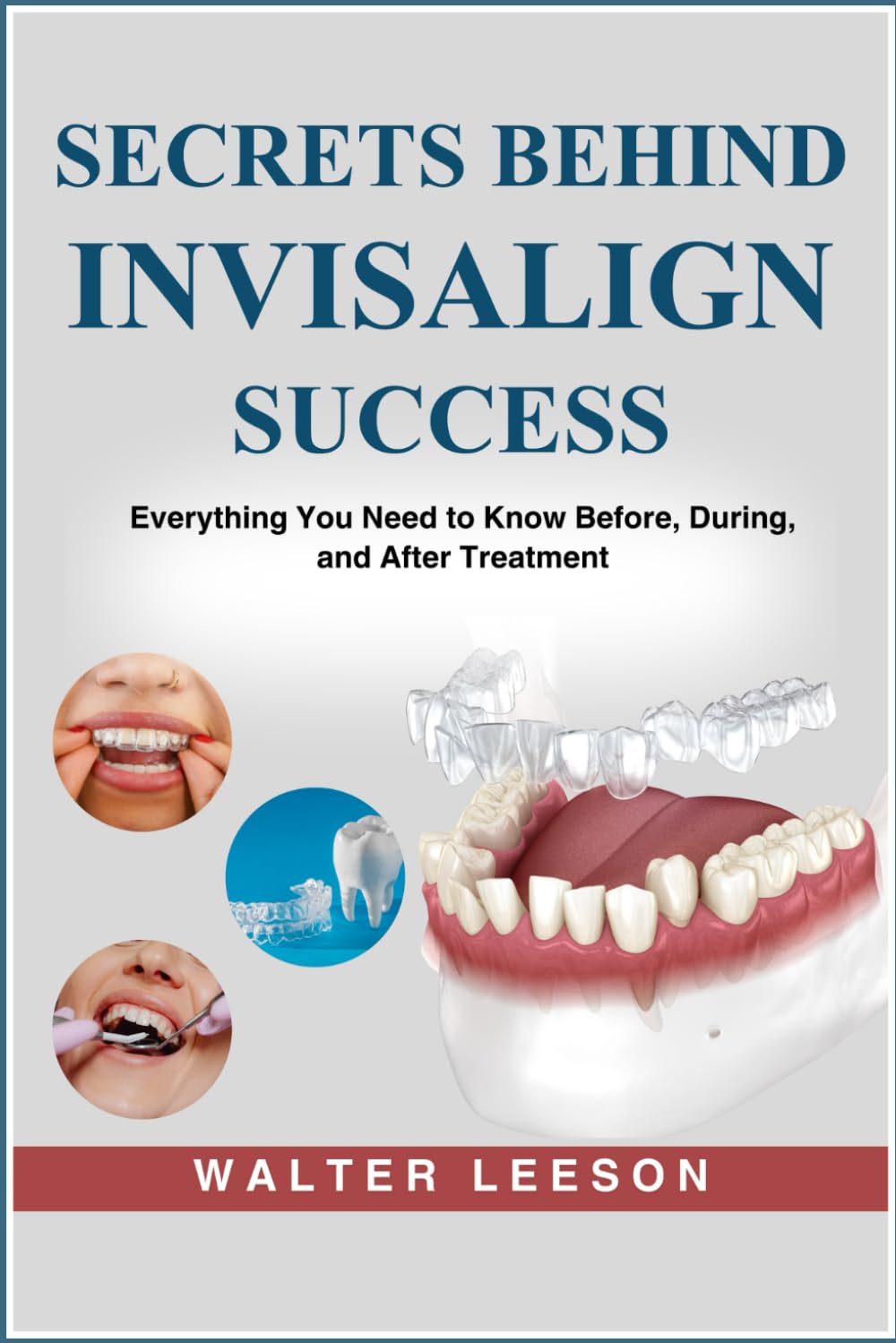 SECRETS BEHIND INVISALIGN SUCCESS