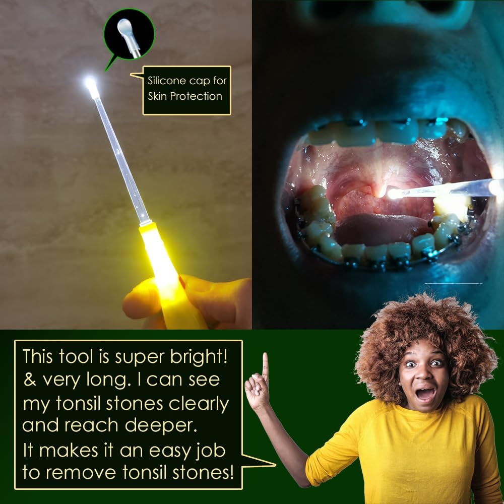 Professional Tonsil Stone Remover Tool LED Light (Yellow) | Stainless Steel Tonsillolith Pick Oral Care | Irrigation Syringe | Tongue Cleaner Scraper
