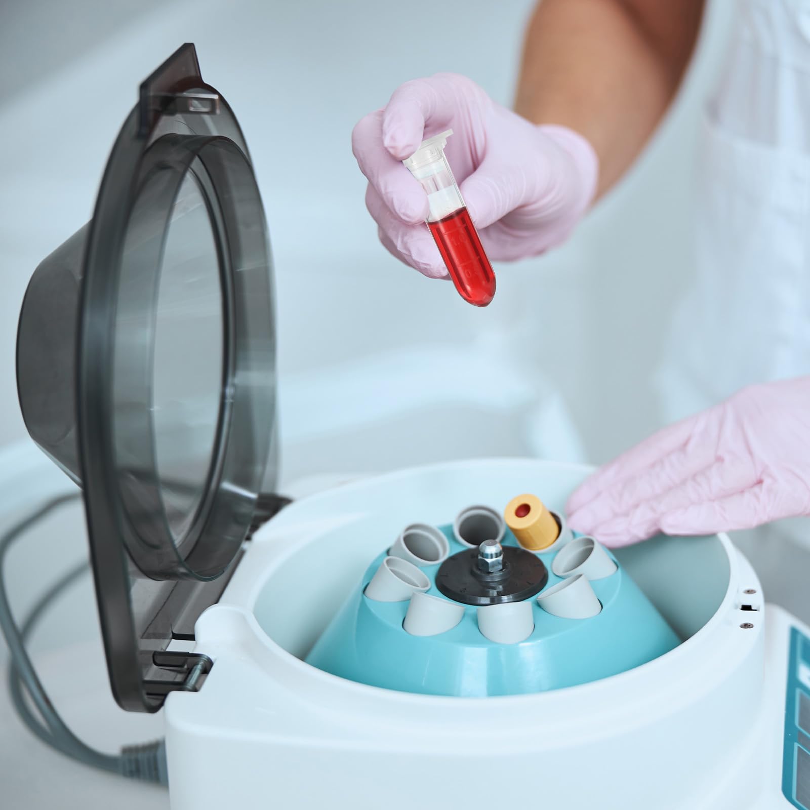 PATIKIL 2ML Tubos De Centrífuga De Plástico 1000 Pcs Tubo De Centrífuga De Fondo Redondo Con Tapa A Presión Y Marcas Graduadas Para Muestras De Laboratorio Amarillo