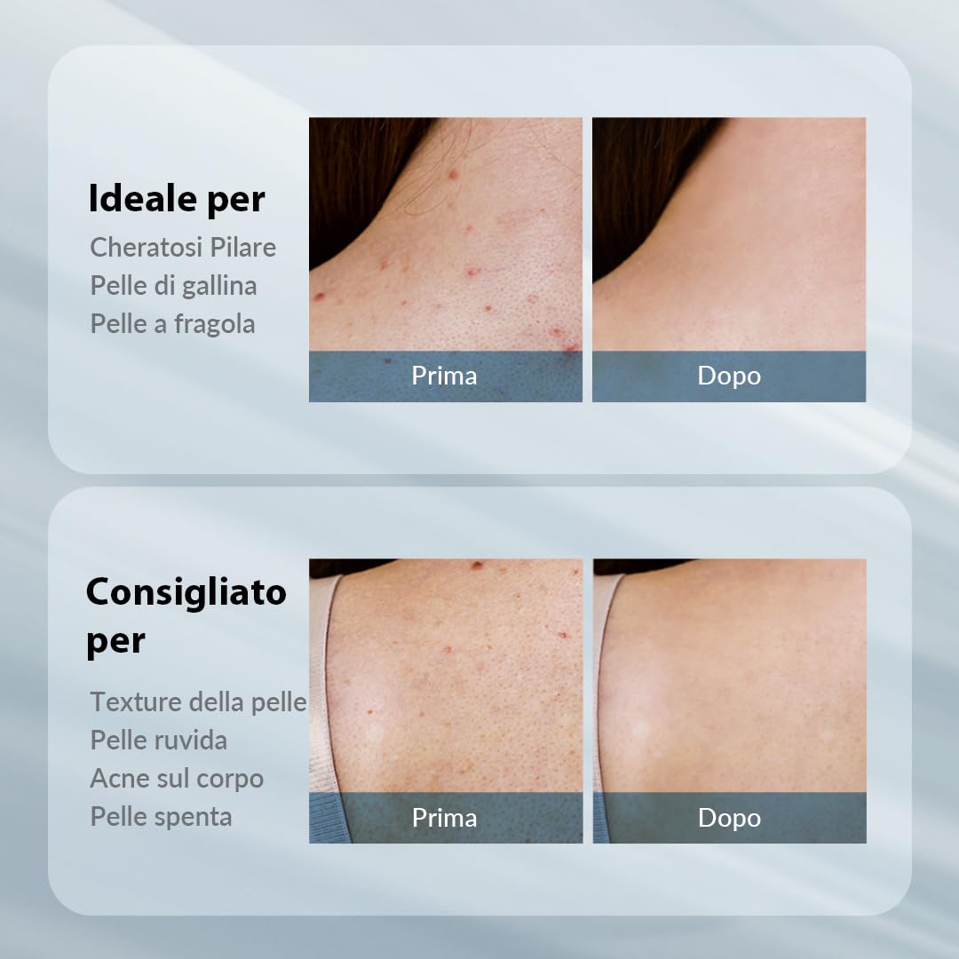 VILLAGE 11 FACTORY lozione per il corpo con acido glicolico AHA 12% (300 g), peeling e ringiovanimento, rimozione delicata delle cellule morte, senza profumo, senza parabeni (AHA Body Lotion)